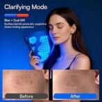 INIA Glow 4D Wireless Red Light Therapy Mask for face – Dual NIR, 320 LEDs, 4 Modes, Under-Eye Cooling, Cordless &amp; Rechargeable LED Face Mask for Home &amp; Travel, Skincare Gifts for Women Mom Wife, Blue - Image 2