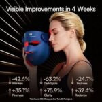 INIA Glow 4D Wireless Red Light Therapy Mask for face – Dual NIR, 320 LEDs, 4 Modes, Under-Eye Cooling, Cordless &amp; Rechargeable LED Face Mask for Home &amp; Travel, Skincare Gifts for Women Mom Wife, Blue - Image 4